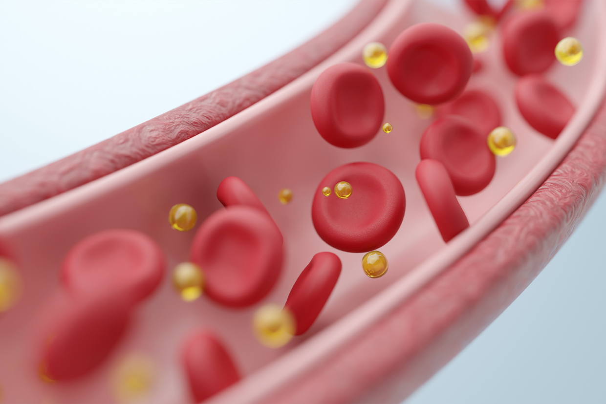 血液吸着療法（レオカーナを使用）